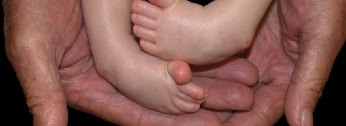 Parent's Guide to Navigating Clubfoot Treatment