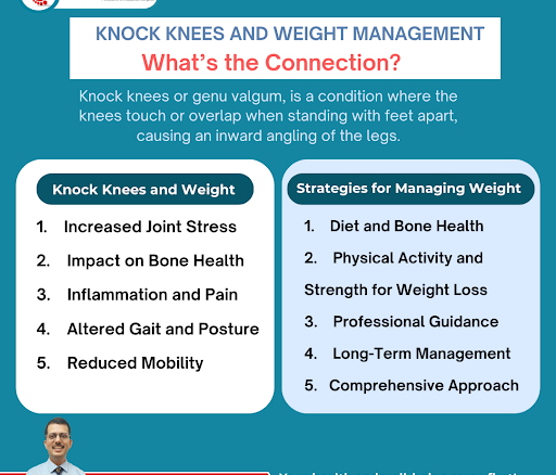 Knock knee treatment