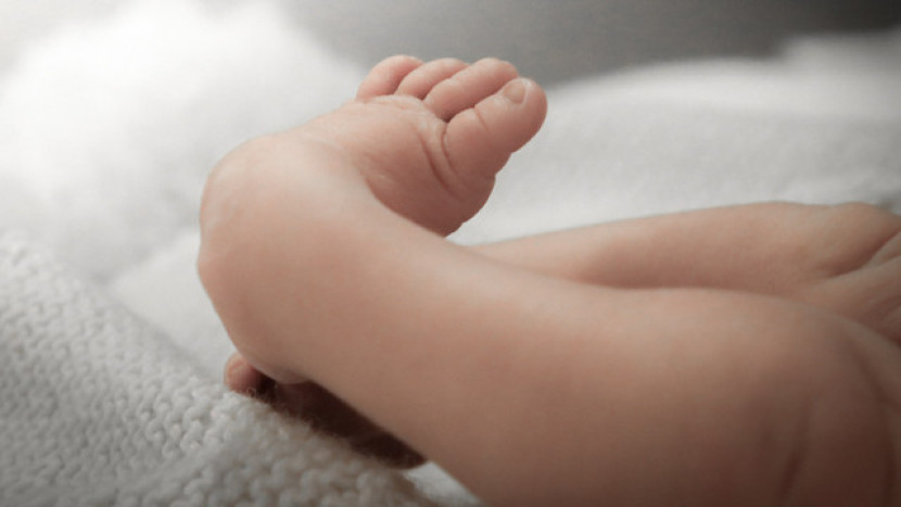 Club Foot specialist in Pune