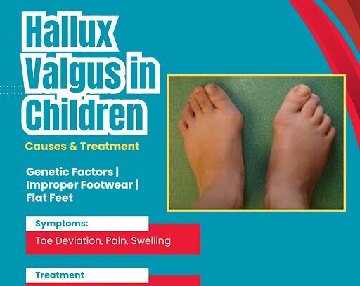 Best Hallux Valgus Treatment in Children
