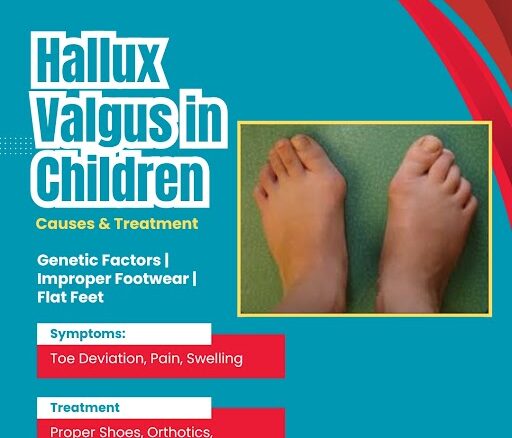 Best Hallux Valgus Treatment in Children